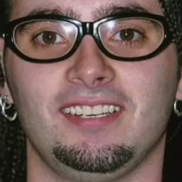 Chris Kirkpatrick
